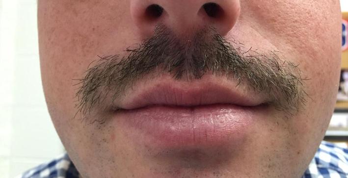 Men's Lacrosse participating in Movember, raising money to fight cancer